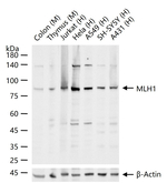 MLH1 Recombinant Rabbit Monoclonal Antibody (R6E5)