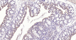 PTP1B Antibody in Immunohistochemistry (Paraffin) (IHC (P))
