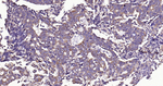 PTP1B Antibody in Immunohistochemistry (Paraffin) (IHC (P))