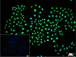 ROC1 Recombinant Rabbit Monoclonal Antibody (R2D3)