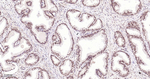 ROC1 Antibody in Immunohistochemistry (Paraffin) (IHC (P))