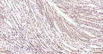 ROC1 Antibody in Immunohistochemistry (Paraffin) (IHC (P))