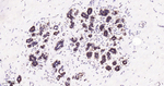 ROC1 Antibody in Immunohistochemistry (Paraffin) (IHC (P))