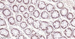 ROC1 Antibody in Immunohistochemistry (Paraffin) (IHC (P))