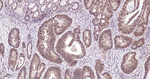 ROC1 Antibody in Immunohistochemistry (Paraffin) (IHC (P))