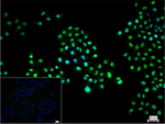 CHD3 Recombinant Rabbit Monoclonal Antibody (R3C6)