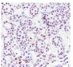 CHD3 Antibody in Immunohistochemistry (Paraffin) (IHC (P))
