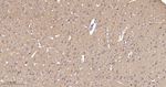 SQSTM1 Antibody in Immunohistochemistry (Paraffin) (IHC (P))