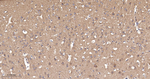 SQSTM1 Antibody in Immunohistochemistry (Paraffin) (IHC (P))