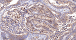 SQSTM1 Antibody in Immunohistochemistry (Paraffin) (IHC (P))