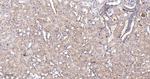 SQSTM1 Antibody in Immunohistochemistry (Paraffin) (IHC (P))