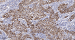 SQSTM1 Antibody in Immunohistochemistry (Paraffin) (IHC (P))