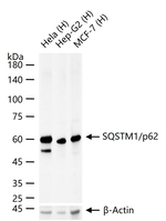 SQSTM1 Antibody in Western Blot (WB)