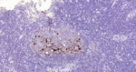 Calbindin D28K Antibody in Immunohistochemistry (Paraffin) (IHC (P))