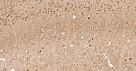 Calbindin D28K Antibody in Immunohistochemistry (Paraffin) (IHC (P))