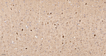 Calbindin D28K Antibody in Immunohistochemistry (Paraffin) (IHC (P))