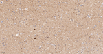 Calbindin D28K Antibody in Immunohistochemistry (Paraffin) (IHC (P))