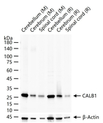 Calbindin D28K Antibody in Western Blot (WB)