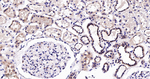 FGFR3 Antibody in Immunohistochemistry (Paraffin) (IHC (P))
