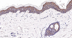 FGFR3 Antibody in Immunohistochemistry (Paraffin) (IHC (P))