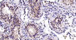 FGFR3 Recombinant Rabbit Monoclonal Antibody (R5D9)