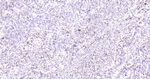 Ki-67 Antibody in Immunohistochemistry (Paraffin) (IHC (P))