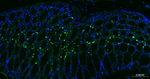 Ki-67 Antibody in Immunohistochemistry (Paraffin) (IHC (P))