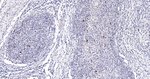 Ki-67 Antibody in Immunohistochemistry (Paraffin) (IHC (P))