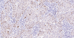 Ki-67 Antibody in Immunohistochemistry (Paraffin) (IHC (P))