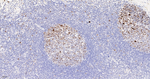 Ki-67 Antibody in Immunohistochemistry (Paraffin) (IHC (P))