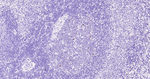 Ki-67 Antibody in Immunohistochemistry (Paraffin) (IHC (P))