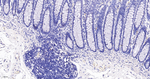 Ki-67 Antibody in Immunohistochemistry (Paraffin) (IHC (P))