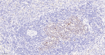 Ki-67 Antibody in Immunohistochemistry (Paraffin) (IHC (P))