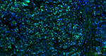 Ki-67 Antibody in Immunohistochemistry (Paraffin) (IHC (P))