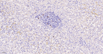 Ki-67 Antibody in Immunohistochemistry (Paraffin) (IHC (P))