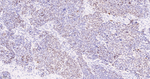 Ki-67 Antibody in Immunohistochemistry (Paraffin) (IHC (P))