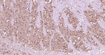MEK1 Antibody in Immunohistochemistry (Paraffin) (IHC (P))