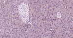 MEK1 Antibody in Immunohistochemistry (Paraffin) (IHC (P))
