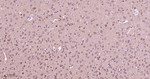 MEK1 Antibody in Immunohistochemistry (Paraffin) (IHC (P))