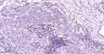 MEK1 Antibody in Immunohistochemistry (Paraffin) (IHC (P))