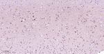 MEK1 Antibody in Immunohistochemistry (Paraffin) (IHC (P))