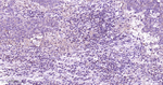 MEK1 Antibody in Immunohistochemistry (Paraffin) (IHC (P))