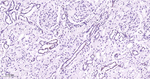 MEK1 Antibody in Immunohistochemistry (Paraffin) (IHC (P))