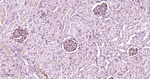 MEK1 Antibody in Immunohistochemistry (Paraffin) (IHC (P))