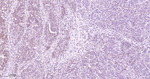 MEK1 Recombinant Rabbit Monoclonal Antibody (B5E1)
