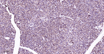 MEK1 Antibody in Immunohistochemistry (Paraffin) (IHC (P))