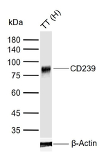 BCAM Antibody in Western Blot (WB)