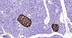 Chromogranin A Antibody in Immunohistochemistry (Paraffin) (IHC (P))