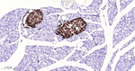 Chromogranin A Antibody in Immunohistochemistry (Paraffin) (IHC (P))