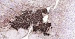 Chromogranin A Antibody in Immunohistochemistry (Paraffin) (IHC (P))